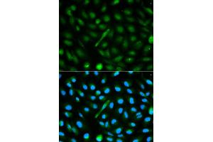 Immunofluorescence analysis of MCF-7 cells using AHSG antibody. (Fetuin A Antikörper)