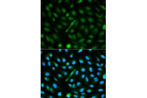 Immunofluorescence analysis of MCF-7 cells using AHSG antibody.