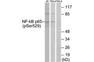 Western Blotting (WB) image for anti-Nuclear Factor-kB p65 (NFkBP65) (pSer529) antibody (ABIN2888481) (NF-kB p65 Antikörper  (pSer529))