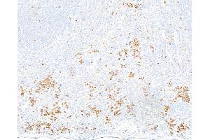 Immunohistochemistry (IHC) image for anti-Topo IIalpha (AA 650-700) antibody (ABIN7795794)