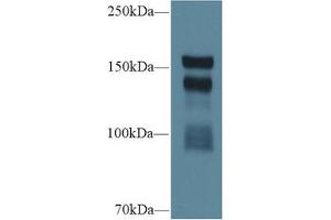 Western blot analysis of Rat Serum, using Rat THBS1 Antibody (1 µg/ml) and HRP-conjugated Goat Anti-Rabbit antibody ( (Thrombospondin 1 Antikörper  (AA 511-670))