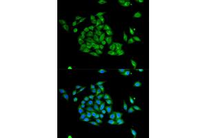 Immunofluorescence analysis of HeLa cell using PICK1 antibody. (PICK1 Antikörper  (AA 260-360))