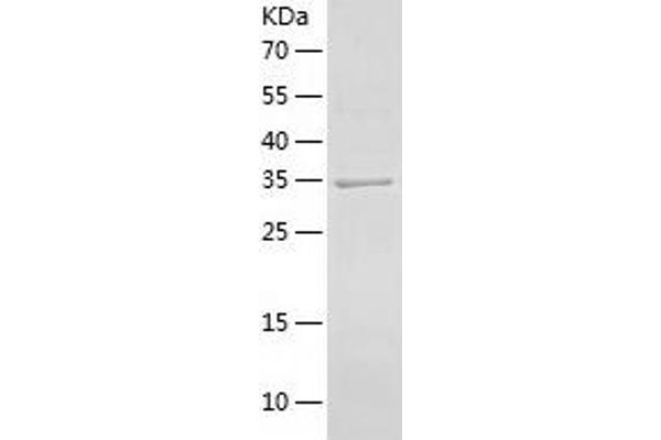 ARFIP2 Protein (AA 1-341) (His tag)