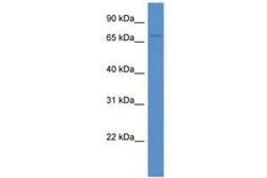 Image no. 1 for anti-Acyl-CoA Synthetase Medium-Chain Family Member 3 (ACSM3) (C-Term) antibody (ABIN6746571) (ACSM3 Antikörper  (C-Term))