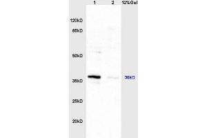 Lane 1: mouse liver lysates Lane 2: mouse intestine lysates probed with Anti HSD17B1/HSD17 Polyclonal Antibody, Unconjugated  at 1:200 in 4˚C. (HSD17B1 Antikörper  (AA 21-120))