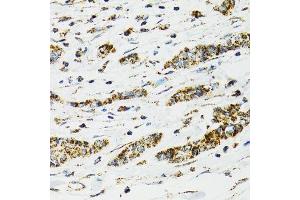 Immunohistochemistry (Paraffin-embedded Sections) (IHC (p)) image for anti-Heat Shock 70kDa Protein 9 (Mortalin) (HSPA9) (AA 380-679) antibody (ABIN3021000)