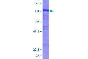 B-Cell Linker Protein (BLNK) (AA 1-456) (GST tag)