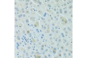 Immunohistochemistry of paraffin-embedded mouse liver using PDC antibody (ABIN6293719) at dilution of 1:100 (40x lens). (Phosducin Antikörper)