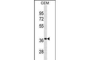 TT Antibody (Center) (ABIN1881957 and ABIN2838927) western blot analysis in CEM cell line lysates (35 μg/lane). (TTPA Antikörper  (AA 82-108))