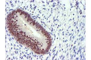 Immunohistochemical staining of paraffin-embedded Human endometrium tissue using anti-PDSS2 mouse monoclonal antibody. (PDSS2 Antikörper)