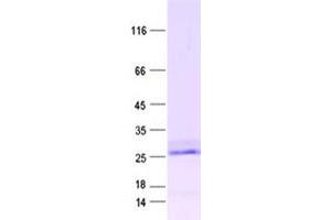 Proline Rich 15 Protein (PRR15) (DYKDDDDK Tag)