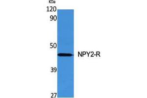 Western Blot (WB) analysis of specific cells using NPY2-R Polyclonal Antibody. (NPY2R Antikörper  (N-Term))