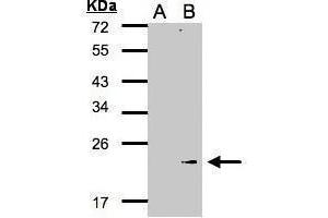 WB Image Western Blot analysis of GPX7 expression in transfected 293T cell line by GPX7 polyclonal antibody. (Glutathione Peroxidase 7 Antikörper)