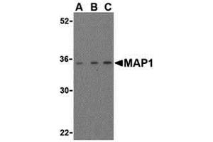 Western Blotting (WB) image for anti-Mannosidase Processing 1 (MAP1) (Middle Region) antibody (ABIN1030994)