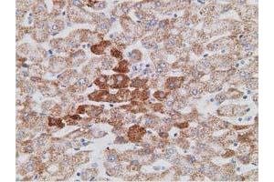Immunohistochemical staining of paraffin-embedded Human liver tissue using anti-PECR mouse monoclonal antibody. (PECR Antikörper)