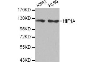 Western Blotting (WB) image for anti-Hypoxia Inducible Factor 1, alpha Subunit (Basic Helix-Loop-Helix Transcription Factor) (HIF1A) antibody (ABIN1980281) (HIF1A Antikörper)