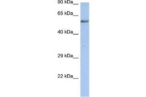 WB Suggested Anti-ZNF513 Antibody Titration: 0.