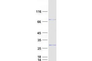 Western Blotting (WB) image for Cysteine-Rich Hydrophobic Domain 2 (CHIC2) protein (Myc-DYKDDDDK Tag) (ABIN2713975)