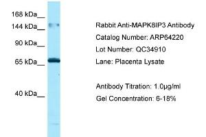 Western Blotting (WB) image for anti-Mitogen-Activated Protein Kinase 8 Interacting Protein 3 (MAPK8IP3) (N-Term) antibody (ABIN2789770) (JIP3 Antikörper  (N-Term))
