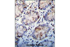 C1QC Antibody immunohistochemistry analysis in formalin fixed and paraffin embedded human rectum tissue followed by peroxidase conjugation of the secondary antibody and DAB staining. (C1QC Antikörper  (AA 93-120))