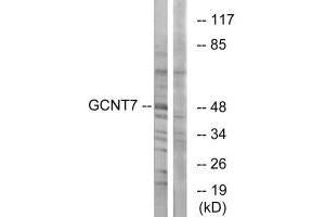 Western blot analysis of extracts from K562 cells, using GCNT7 antibody. (GCNT7 Antikörper)