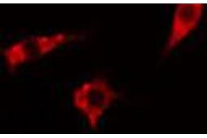 ABIN6267570 staining Hela cells by IF/ICC. (ADAM17 Antikörper  (pThr735))