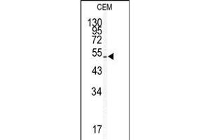 Western blot analysis of KLF5 antibody in CEM cell line lysates (35ug/lane)