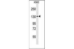 Image no. 1 for anti-Valyl-tRNA Synthetase (VARS) (N-Term) antibody (ABIN360195) (VARS Antikörper  (N-Term))