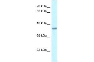 WB Suggested Anti-Pitx1 Antibody   Titration: 1.