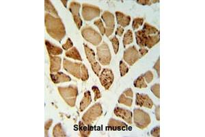5NT1A Antibody (N-term) IHC analysis in formalin fixed and paraffin embedded skeletal muscle followed by peroxidase conjugation of the secondary antibody and DAB staining. (NT5C1A Antikörper  (N-Term))