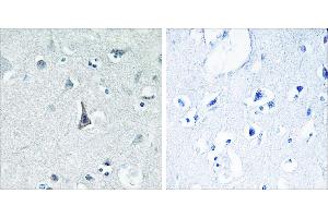 Peptide - +Immunohistochemistry analysis of paraffin-embedded human brain tissue using Cytochrome P450 3A4 antibody. (CYP3A4 Antikörper)