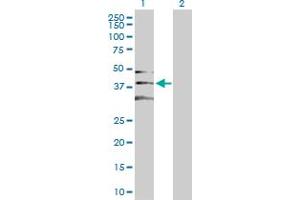 Western Blot analysis of CDK2 expression in transfected 293T cell line by CDK2 MaxPab polyclonal antibody. (CDK2 Antikörper  (AA 1-298))
