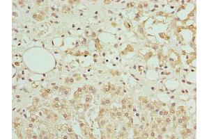 Immunohistochemistry of paraffin-embedded human adrenal gland tissue using ABIN7144341 at dilution of 1:100 (Antizyme Inhibitor 1 Antikörper  (AA 101-400))
