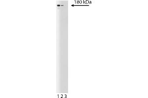 Western Blotting (WB) image for anti-SWI/SNF Related, Matrix Associated, Actin Dependent Regulator of Chromatin, Subfamily A, Member 2 (SMARCA2) (AA 1400-1586) antibody (ABIN967939)