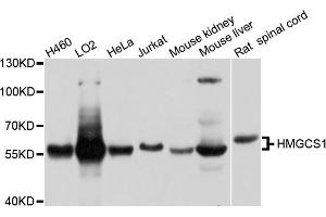 Western blot analysis of extracts of various cell lines, using HMGCS1 antibody. (HMGCS1 Antikörper)
