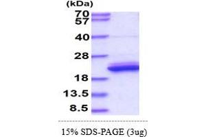 SDS-PAGE (SDS) image for Lipocalin 1 (LCN1) (AA 19-176) protein (His tag) (ABIN5777845) (Lipocalin 1 Protein (LCN1) (AA 19-176) (His tag))