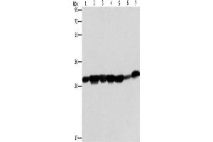 Western Blotting (WB) image for anti-Adenylate Kinase 2 (AK2) antibody (ABIN2422842) (Adenylate Kinase 2 Antikörper)