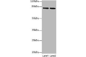 Western blot All lanes: FOLH1 antibody at 2 μg/mL Lane 1: U251 whole cell lysate Lane 2: PC-3 whole cell lysate Secondary Goat polyclonal to rabbit IgG at 1/10000 dilution Predicted band size: 85, 13, 10, 78, 83, 81, 79, 51 kDa Observed band size: 85 kDa (PSMA Antikörper  (AA 48-750))