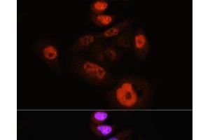 Immunofluorescence analysis of HeLa cells using Phospho-YAP1(S127) Polyclonal Antibody at dilution of 1:100 (40x lens). (YAP1 Antikörper  (pSer127))