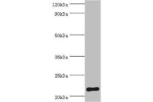 Western blot All lanes: Suppressor of cytokine signaling 2 antibody at 2 μg/mL + HepG2 whole cell lysate Secondary Goat polyclonal to rabbit IgG at 1/10000 dilution Predicted band size: 22 kDa Observed band size: 22 kDa (SOCS2 Antikörper  (AA 1-198))