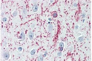 Human Brain, Cortex (formalin-fixed, paraffin-embedded) stained with MBP antibody ABIN364503 at 1:100 followed by biotinylated goat anti-rabbit IgG secondary antibody ABIN481713, alkaline phosphatase-streptavidin and chromogen. (MBP Antikörper)
