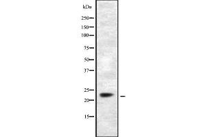 Western blot analysis of DUSP14 using COS7 whole cell lysates (DUSP14 Antikörper)