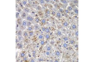 Immunohistochemistry of paraffin-embedded mouse liver using SND1 antibody at dilution of 1:100 (40x lens). (SND1 Antikörper)