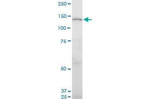 UNC13D monoclonal antibody (M05), clone 2C7. (UNC13D Antikörper  (AA 2-100))