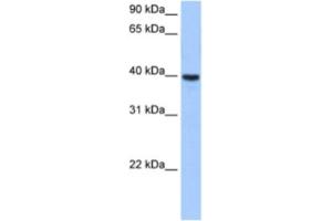 Western Blotting (WB) image for anti-ST6 (Alpha-N-Acetyl-Neuraminyl-2,3-beta-Galactosyl-1,3)-N-Acetylgalactosaminide alpha-2,6-Sialyltransferase 4 (ST6GALNAC4) antibody (ABIN2463264) (ST6GALNAC4 Antikörper)