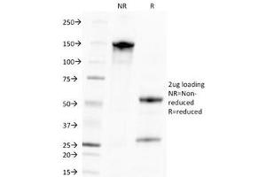 SDS-PAGE Analysis of Purified, BSA-Free CMV Antibody (clone CMV100). (Cytomegalovirus (CMV) Antikörper)