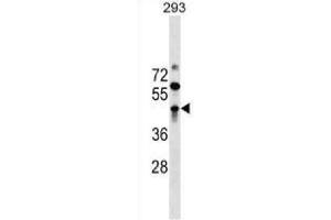 Western blot analysis in 293 cell line lysates (35 ug/ml) using. (ZBTB32 Antikörper  (AA 96-125) (APC))