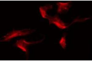 ABIN6275562 staining 293 by IF/ICC. (SH2D5 Antikörper  (C-Term))