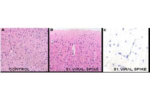 IHC Results in mice after tail vein injection of spike S1 subunit.