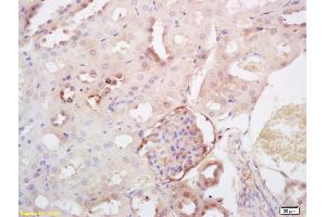 Formalin-fixed and paraffin embedded rat kidney labeled with Rabbit Anti SULT2A1 Polyclonal Antibody, Unconjugated (ABIN712916) at 1:200 followed by conjugation to the secondary antibody and DAB staining (SULT2A1 Antikörper  (AA 91-170))